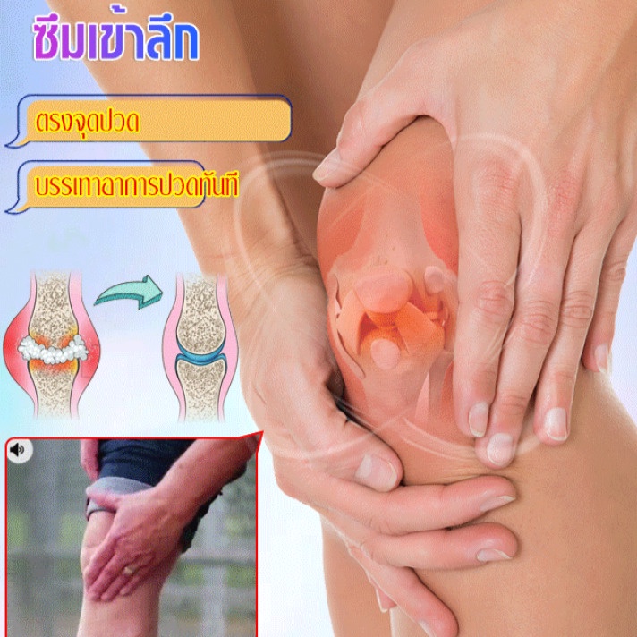 ครีมรักษาโรคเกาต์-ครีมแก้ปวด