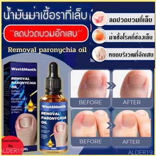 น้ำมันลดเชื้อราเล็บ Removal paronychia oil น้ำมันฆ่าเชื้อราที่เล็บลดปวดบวมอักเสบ ลดปวดบวม เล็บอักเสบ บำรุงเล็บ