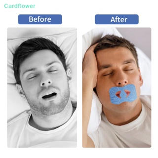 &lt;Cardflower&gt; สติกเกอร์เทปปิดปาก ป้องกันการนอนกรน สําหรับเด็ก 20 ชิ้น ต่อถุง