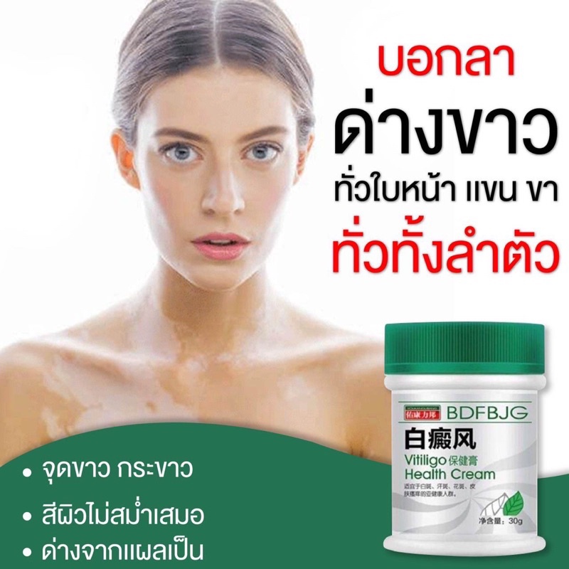 ในสต็อก-โปรโมชั่น-ผิวด่างขาวครีมสมุนไพรจีน-vitiligo-health-creamช่วยได้