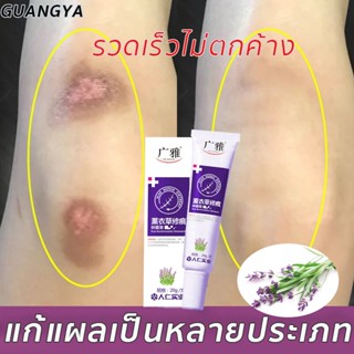 ครีมลบแผลเป็น 20g เป็นต้นแผลเป็นหลายประเภท ลบลอยแผลเป็นครีมลดแผลเป็น ครีมกำจัดแผลเป็นครีมลดรอยสิว รอยแผลเป็น แผลเป็น