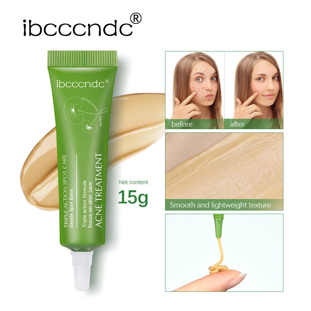 ibcccndc-ครีมรักษาสิว-ควบคุมความมัน-ให้ความชุ่มชื้น-กระชับรูขุมขน