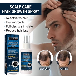 Spot second hair# East moon Mens hair growth spray hairline anti-thick growth dense hair fixed hair care solution 8cc