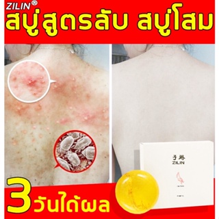 สบู่หน้าขาวใส สบู่ลดสิวหลัง ขจัดสิและไรฝุ่นทำความสะอาดผิวอย่างล้ำลึก สบู่ เร่งผิวขาว ป้องกันผิวมัน