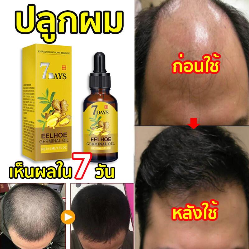 eelhoe-เซรั่มปลูกผม-40ml-ฟื้นฟูผมแห้งเสีย-แก้ปัญหาผมร่วง-ลดผมร่วง-บำรุงรากผม-ดูแลผม-บำรุงผมแห้ง-แตกปลาย-ป้องกันผมร่วง