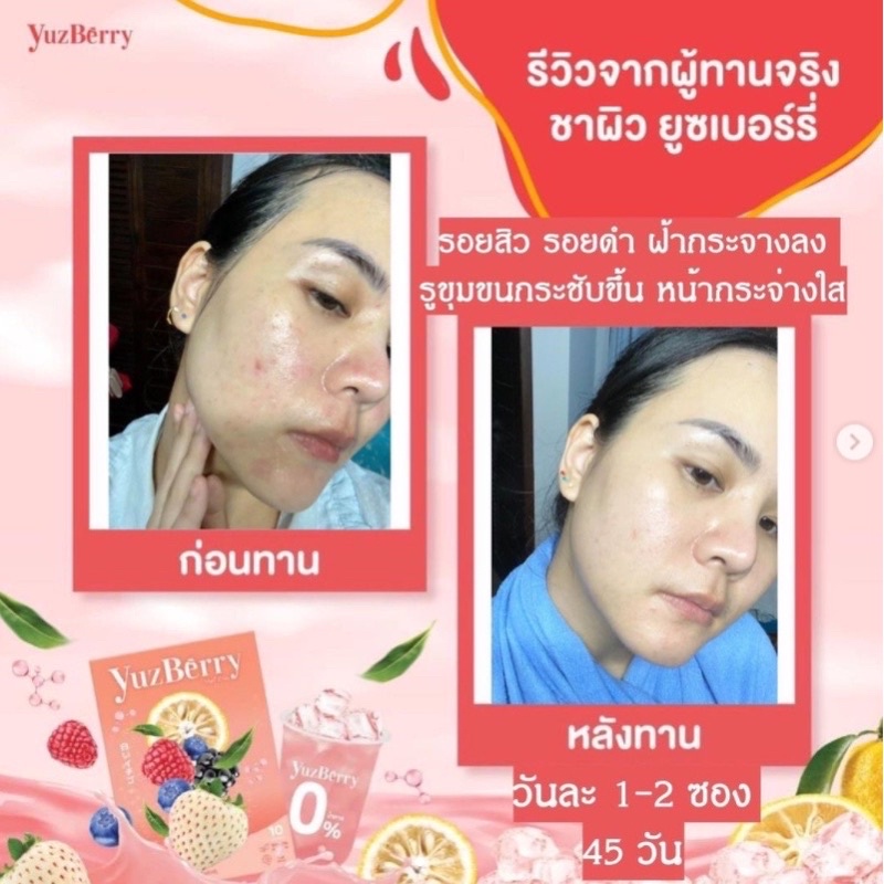 ของแท้-yuzberry-ยูซเบอร์รี่น้ำชงบำรุงผิว-คอลลาเจน-ไฮยาลูรอน-ลดสิว-ผิวขาวใส-ฟื้นฟูผิวสวย-กู้ผิวเสีย-แบบสวยจบในกล่องเดียว