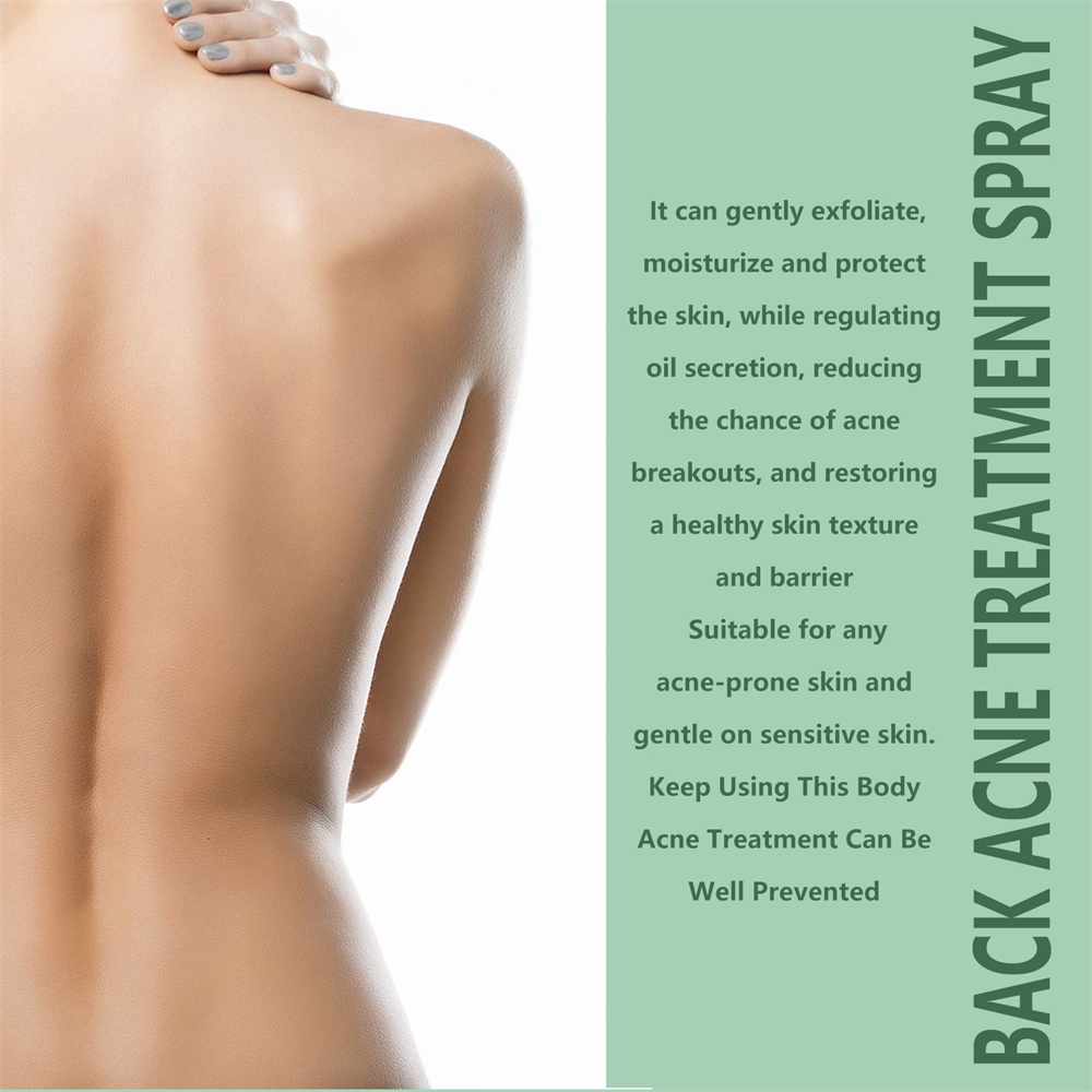 julystar-back-acne-treatment-spray-repairs-back-and-shoulder-acne-lightens-acne-scars-skin-care-spray-120ml-สเปรย์รักษาสิวที่หลัง