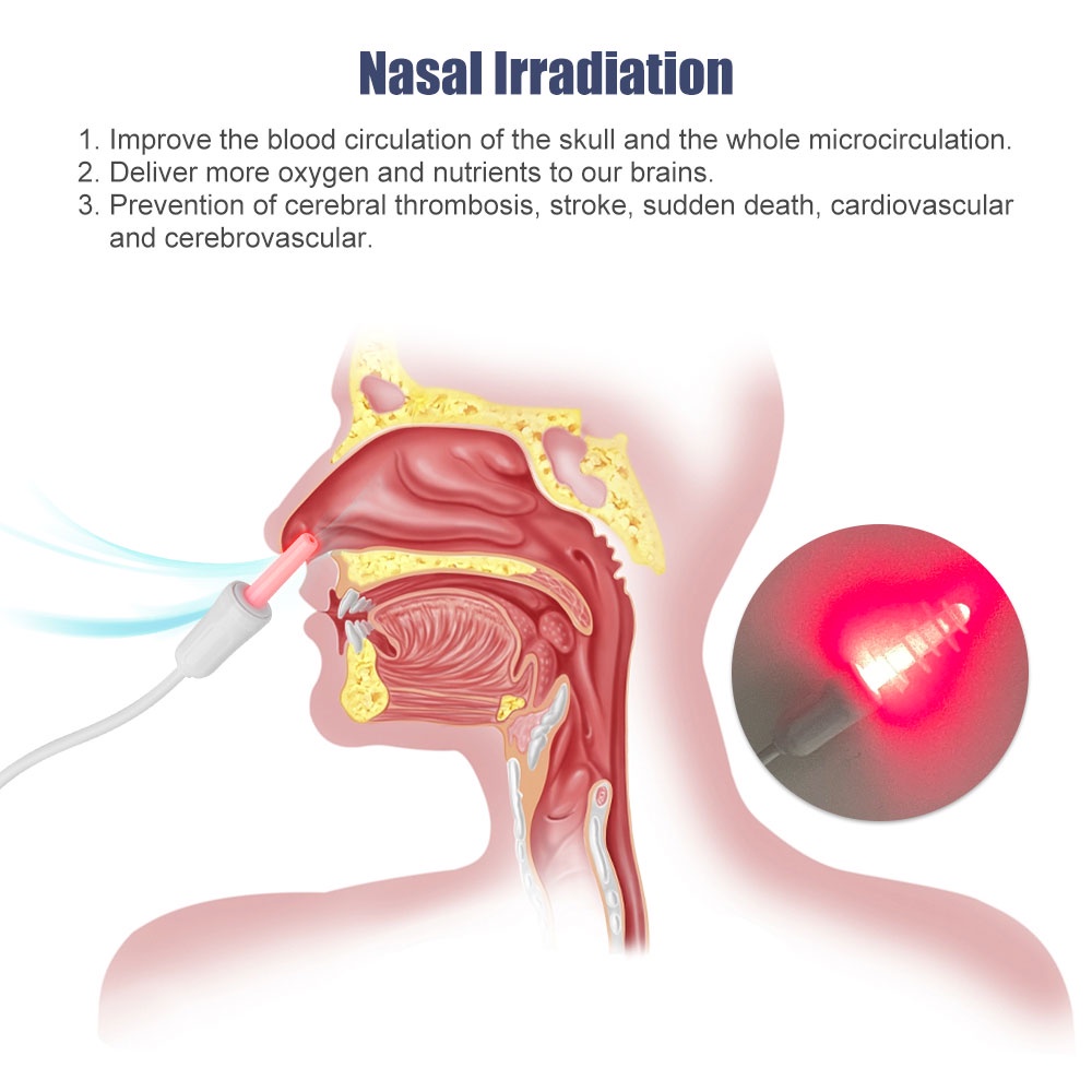 นาฬิกาข้อมือสมาร์ทวอทช์-650nm-lllt-สําหรับ-diabetes-cholesterol-hypertension-treatment-laser-sinusitis