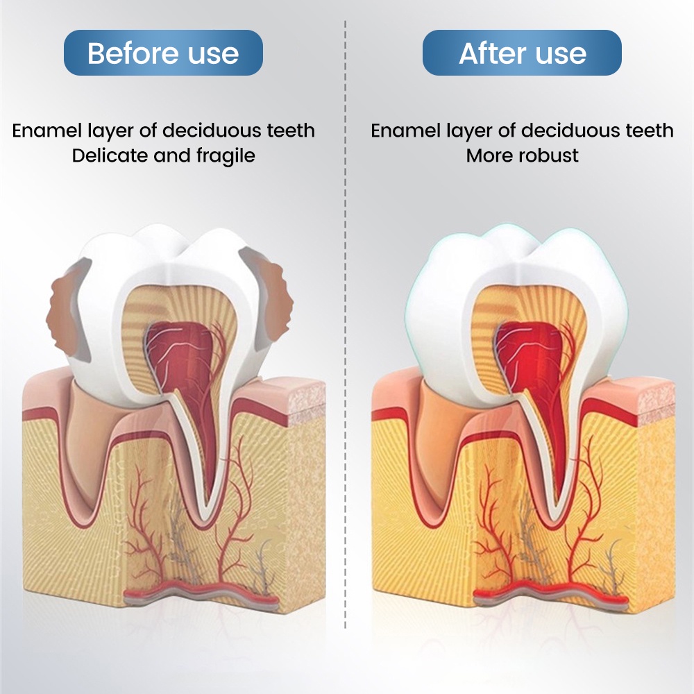 ยาสีฟันเคลือบฟัน-เพิ่มความแข็งแรง-ซ่อมแซมฟันที่บอบบาง-เพื่อฟันที่บอบบางและแข็งแรงเป็นพิเศษ