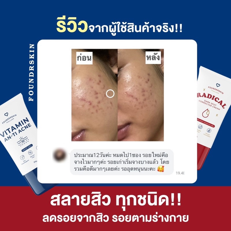 founderskin-ฟาวเดอร์สกิน-set-บำรุงผิวหน้าครบจบ-ฟื้นฟูผิวไหม้จากแดด-บำรุงผิวให้ขาวกระจ่างใส-ชุ่มชื้น-ลดสิว