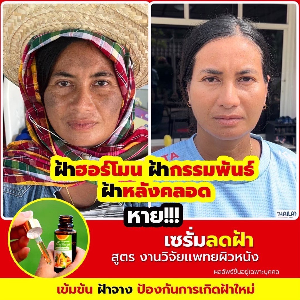 ของแท้-เซรั่มนางพญา-สูตรวิตามินซีเข้มข้น-สารสกัดจากธรรมชาติ-ลดฝ้า-รักษาสิว-ผิวกระจ่างใส-กระชับ-เห็นผลไว