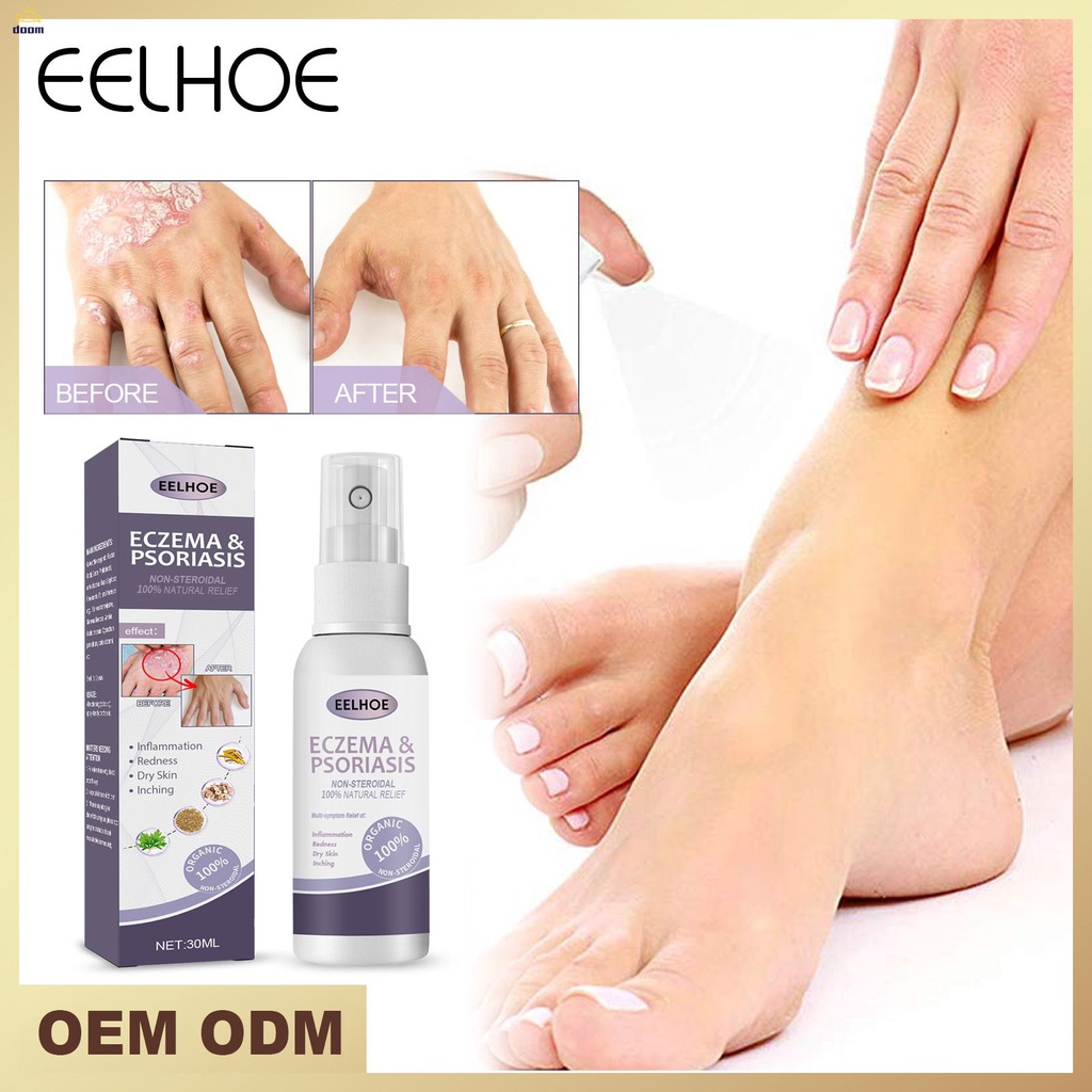 tinea-pedis-สเปรย์-ยารักษาโรคกลาก-30mlหนังศีรษะ-โรคสะเก็ดเงิน-มือ-เท้า-กลิ่นเกลื้อน-ยับยั้งเชื้อรา-ป้องกันอาการคัน-doom