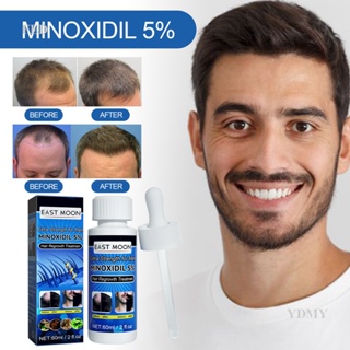 Fedealk Minoxidil น้ํามันปลูกผม 5% แข็งแรงพิเศษ ลดผมร่วง สําหรับผู้ชาย
