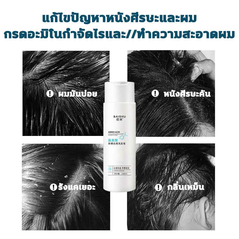 โปรโมชั่น-250ml-แชมพูสระผมแก้เชื้อรา-ยาสระผมแก้เชื้อรา-ยาสระผมเชื้อรา-ขจัดรังแค-เชื้อราบนศีรษะ-ครีมสระผม-ป้องกันรังแ