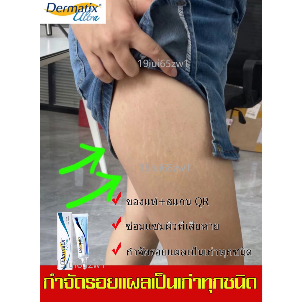 พร้อมส่ง-ของแท้-dermatix-ultra-gel15g-ครีมลดรอยแผลเป็น-สำหรับรอยสิว-ลดรอยแผลเป็น-รอยสิว-ลบรอยแผลเป็น-รักษารอยแผลเป็น