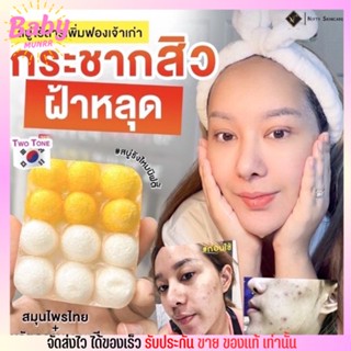 ก้อนใหญ่ นิฟตี้ สบู่ทูโทน Nifty สบู่ ทูโทน สบู่ รังไหม ไหมขาว ไหมทอง หน้าเงา หน้าขาว สิวหาย ลดฝ้า