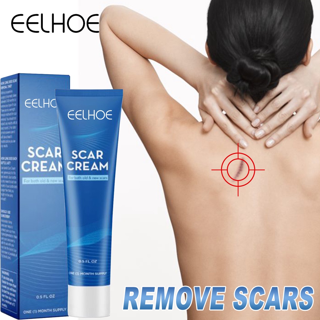 hot-sale-eelhoe-fade-scar-repair-cream-acne-marks-surgery-scar-smooth-skin-care-cream-skin-repair-cream-7-16li