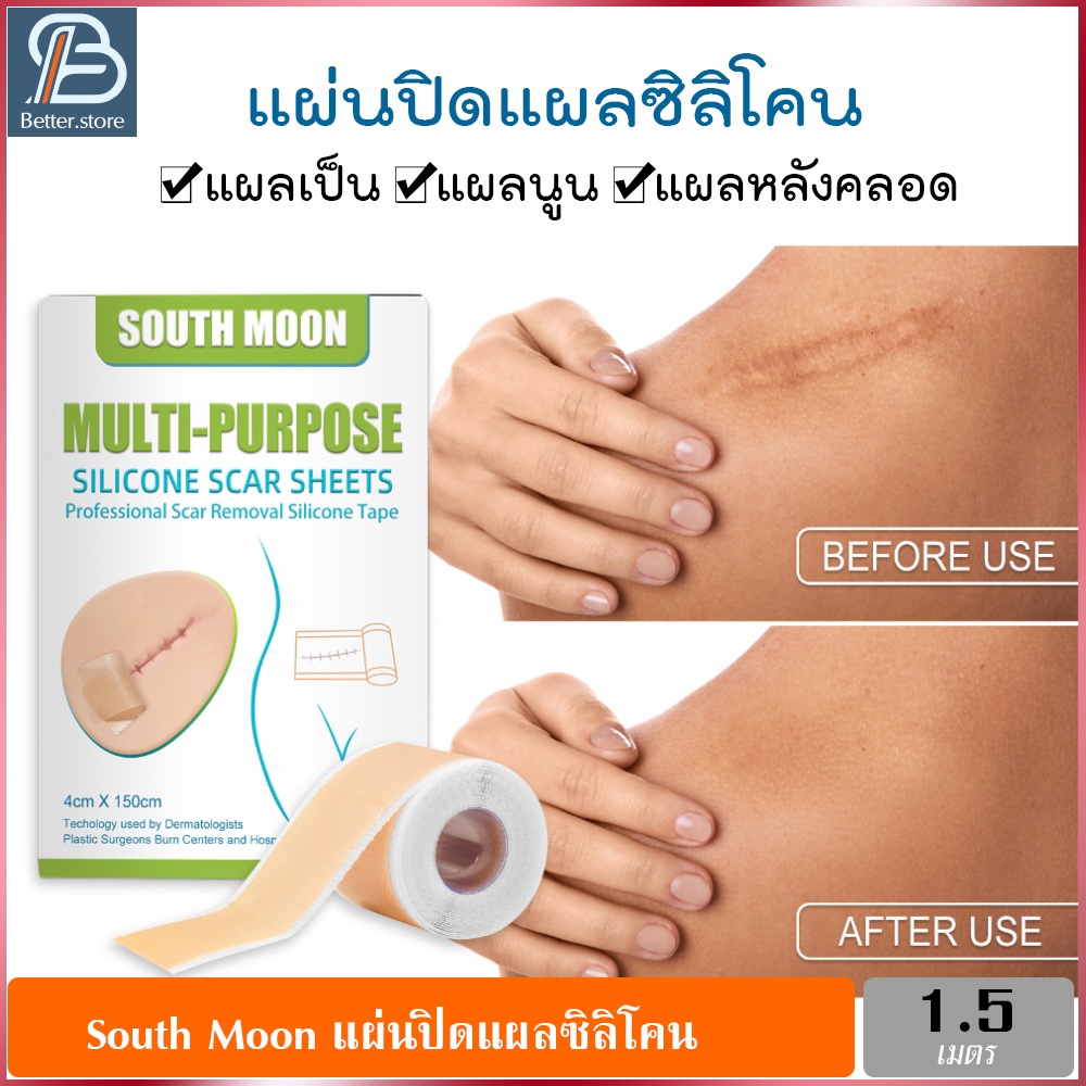 south-moon-แผ่นปิดแผลซิลิโคน-แผ่นแปะรอยแผลเป็น-ซิลิโคนปิดแผล-แผลผ่าตัด-แผลหลังคลอด-ซิลิโคนกำจัดรอยแผลเป็น-ขนาด-4cmx1-5m