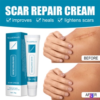 West&amp;month Scar Repair Cream ครีมซ่อมแผลเป็น 20g AUBESSTECHSTORE AUBESSTECHSTORE