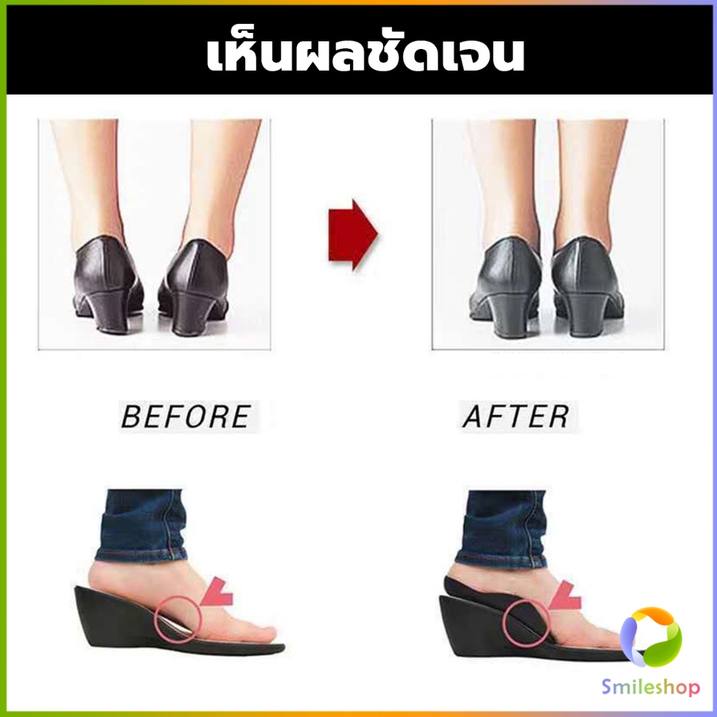 smileshop-แผ่นรองเท้าสำหรับแก้เท้าแบน-1-คู่-กระดูก-ปรับ-โค้ง-ซัพพอร์ต-พื้นรองเท้า-บรรเทาอาการปวด-arch-pad