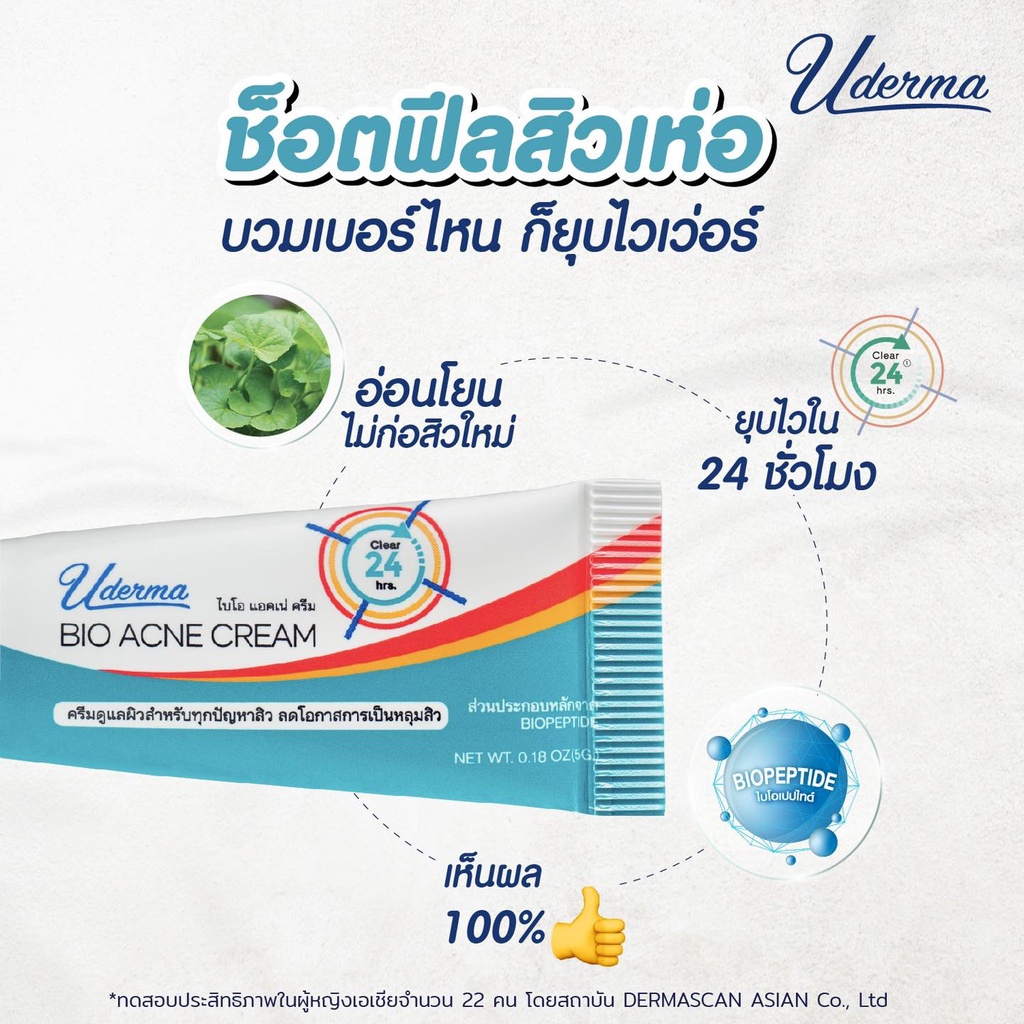 ยูเดอร์มา-ครีมแต้มสิว-uderma-bio-acne-cream-สิวหัวหนอง-สิวอุดตัน-สิวผด-รอยสิวจาง-รอยดำ-รอยแดง-5กรัม