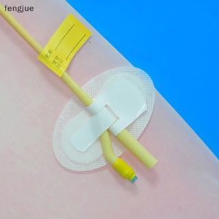 Fengjue สายรัดขา แบบสติกเกอร์ สําหรับถุงปัสสาวะ 1 ชิ้น
