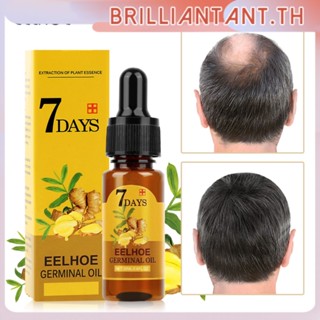 Eelhoe การเจริญเติบโตของเส้นผมขิง Germinal น้ำมันที่มีประสิทธิภาพผมร่วง Treatment Conditioner ขิงธรรมชาติน้ำมันพืช Fast-Growing Hair Care Bri