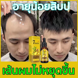 7วั นขิง Germinal น้ำมัน Anti-Hair Loss ยาบำรุงผมสุขภาพผมบำรุงอาหารสูตรสมุนไพรเซรั่มสำหรับส่งเสริมหนาและหนาแน่น