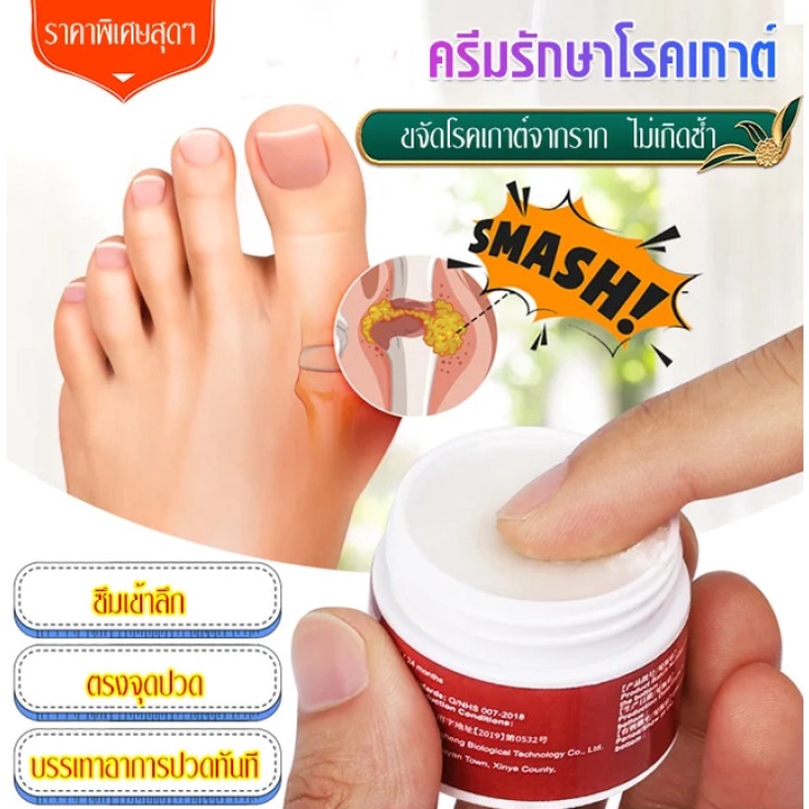 ครีมรักษาโรคเกาต์-ครีมแก้ปวด