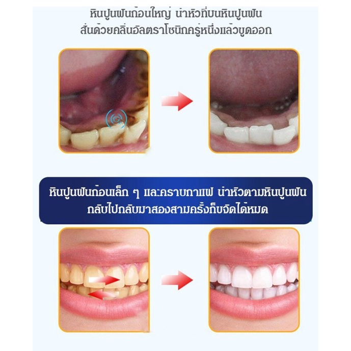 ยาสีฟันไวท์เทนนิ่ง-สูตรไนอาซินาไมด์โปรไบโอติก