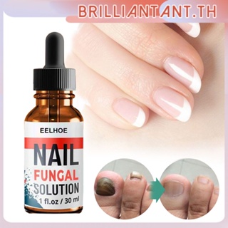 คลังสินค้าพร้อม Eelhoe Nail Fungus Repair Liquid Foot Anti-Fungal Essence Onychomycosis Repair Liquid Healthy Nail Care Repair Liquid Bri