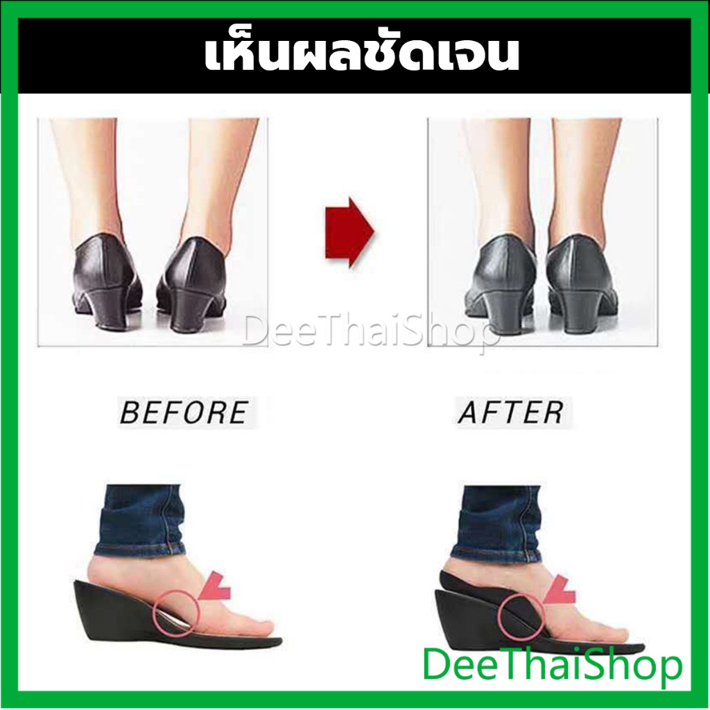 deethai-แผ่นรองเท้าสำหรับแก้เท้าแบน-1-คู่-กระดูก-ปรับ-โค้ง-ซัพพอร์ต-พื้นรองเท้า-บรรเทาอาการปวด-arch-pad