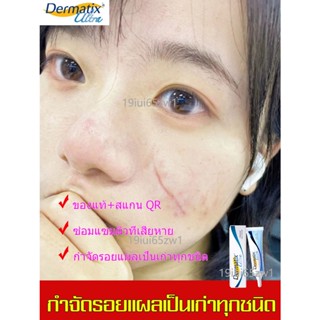 Dermatix Ultra gel 15g เจลลดรอยแผลเป็น ครีมลดรอยแผลเป็น ลดรอยแผลเป็น รอยสิว แผลเผาไหม้ ลบรอยแผลเป็น แผลเป็นจากการผ่าตัด