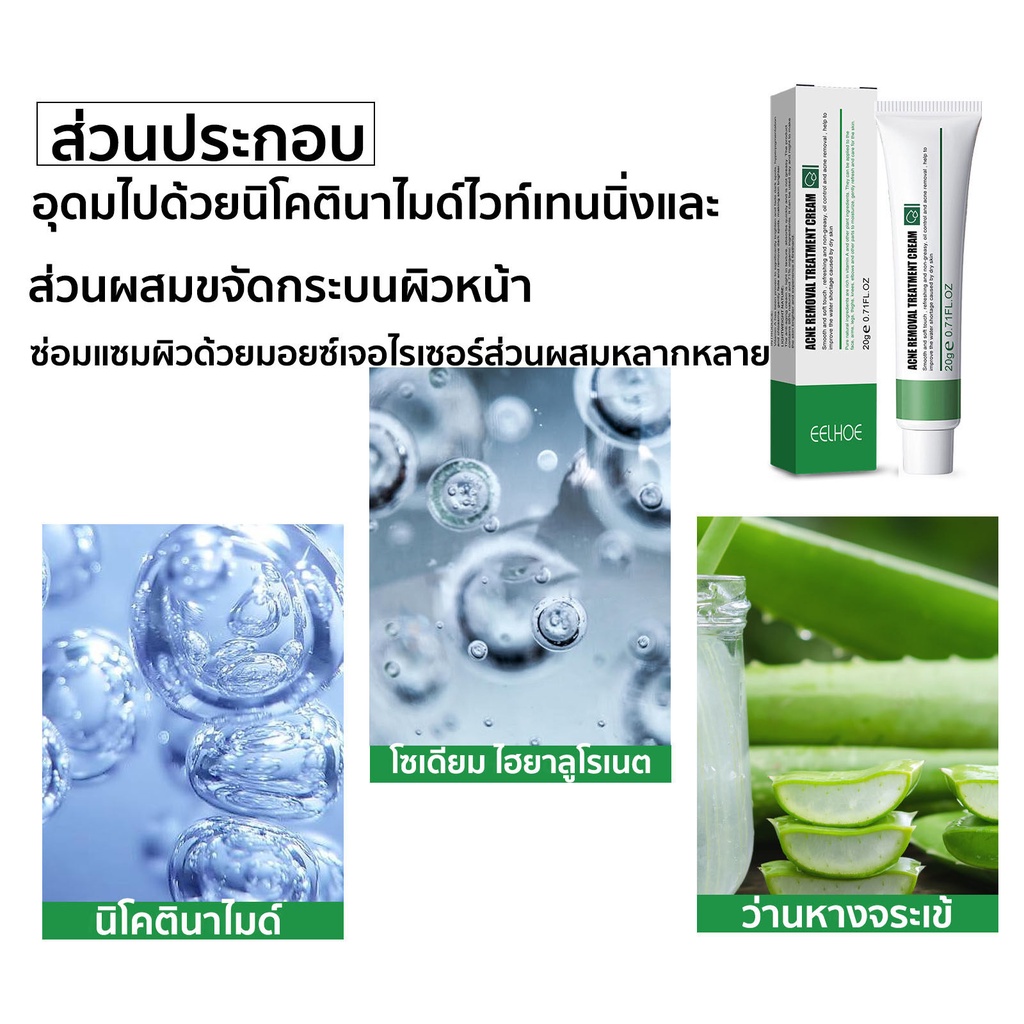 กำจัดสิว-20ml-ลดสิวเสี้ยนครีมรักษาสิว-สลายสิวอุดตันที่ต้นตอ-อ่อนโยนและไม่ระคาย-ครีมลดสิว-ครีมกำจัดสิว-เจลแต้มสิว