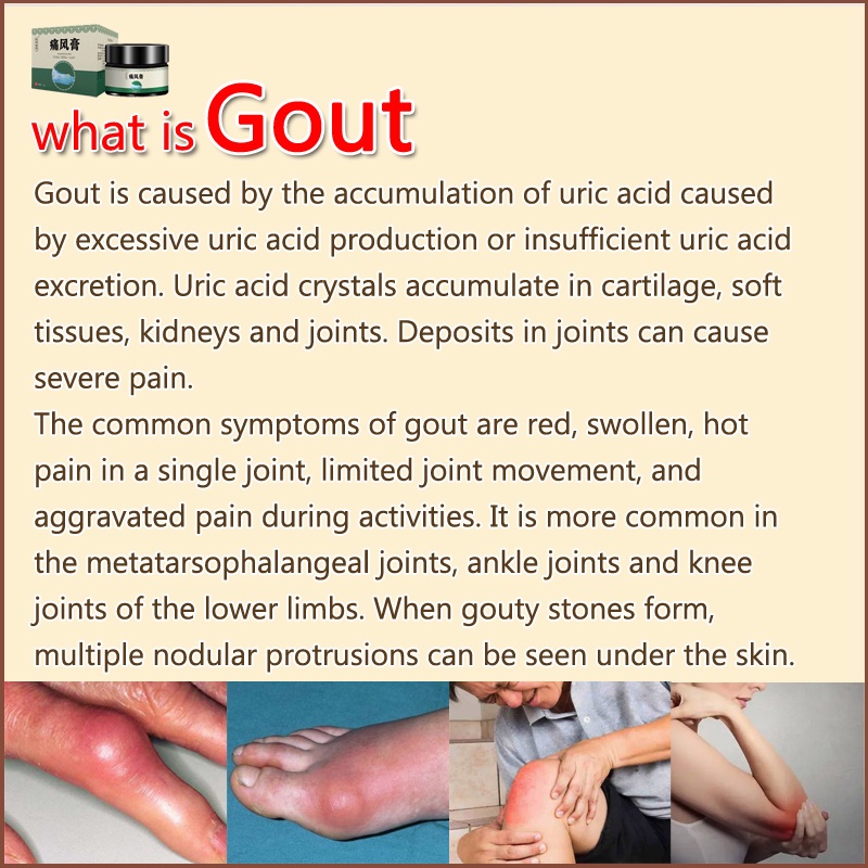 gout-ointment-ครีมรักษาโรคข้ออักเสบ-โรคข้ออักเสบ-ปวดข้อ-ยาแก้ปวดข้อ-สูตรจีน-สมุนไพรธรรมชาติบริสุทธิ์-35-กรัม
