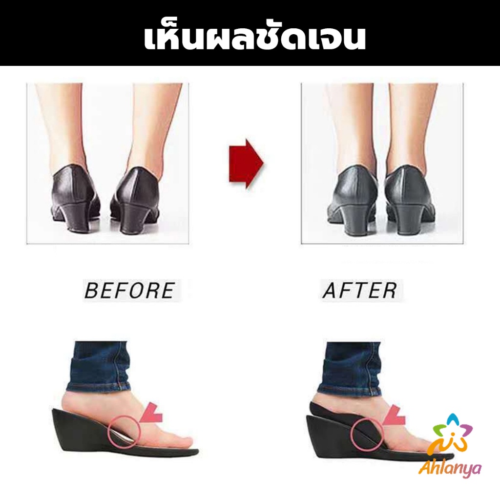 ahlanya-แผ่นรองเท้าสำหรับแก้เท้าแบน-1-คู่-กระดูก-ปรับ-โค้ง-ซัพพอร์ต-พื้นรองเท้า-บรรเทาอาการปวด-arch-pad