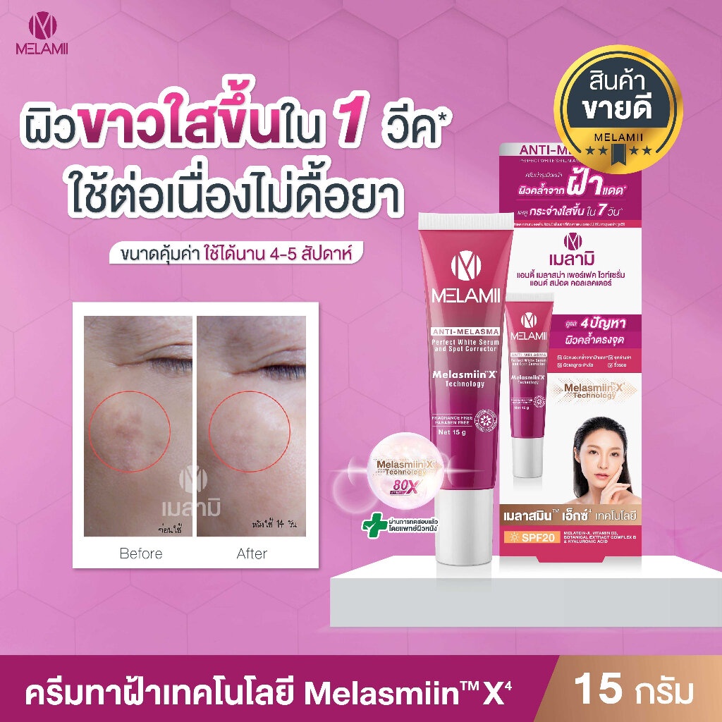 melamii-anti-melasma-เมลามิ-ครีม-ทาฝ้า-ลดฝ้า-ขนาด-15-กรัม-กลาง