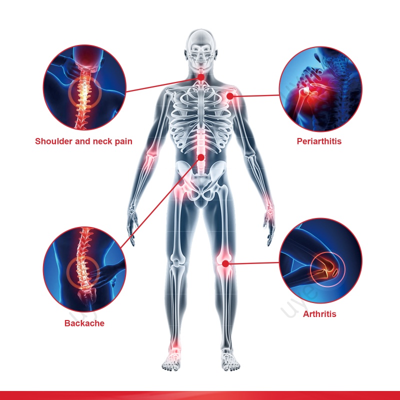 ครีมบรรเทาอาการปวดข้อต่อกระดูกสันหลังส่วนคอ-บรรเทาอาการปวดเอว-ข้อต่อเข่า-ไหล่-และคอ