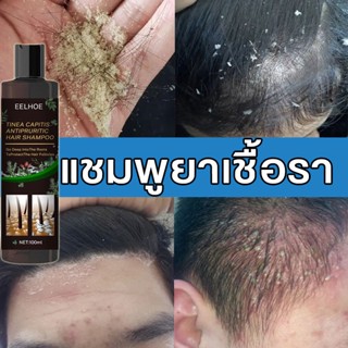 EELHOE 100ml ขจัดรังแค หยุดอาการคัน ควบคุมน้ำมัน แชมพูขจัดรังแค ขจัดรังแค ยาสระผมเชื้อรา แชมพูสมุนไพรยาสระผม ยาสระผมรังแ