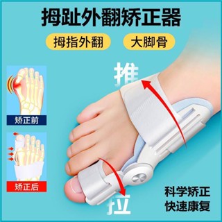 นิ้วหัวแม่มือ แก้ไขนิ้วเท้า กับนิ้วเท้า Valgus เท้า ผู้ชาย ผู้หญิง สามารถสวมใส่ได้ตลอดวัน รองเท้าแก้ไข แยกนิ้วเท้า เครื่องมือที่มีประโยชน์ QTIN