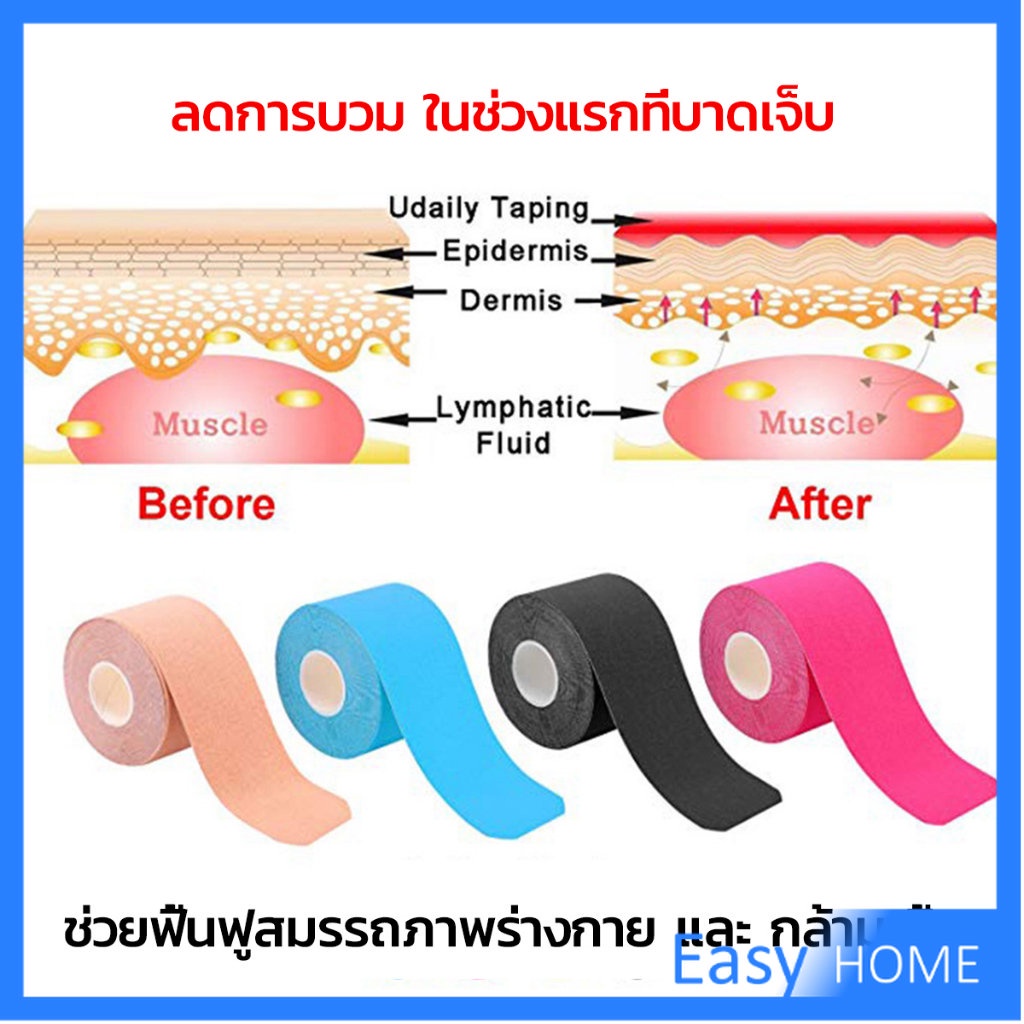 เทปบำบัด-พันกล้ามเนื้อ-5cmx5m-2-5cmx5m-คิเนสิโอ-มีกาวในตัว-sports-bandage