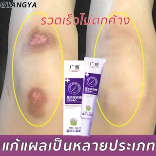 ครีมลบแผลเป็น 20g เป็นต้นแผลเป็นหลายประเภท ลบลอยแผลเป็นครีมลดแผลเป็น ครีมลบรอยแผลดำ ครีมกำจัดแผลเป็นครีมลดรอยสิว