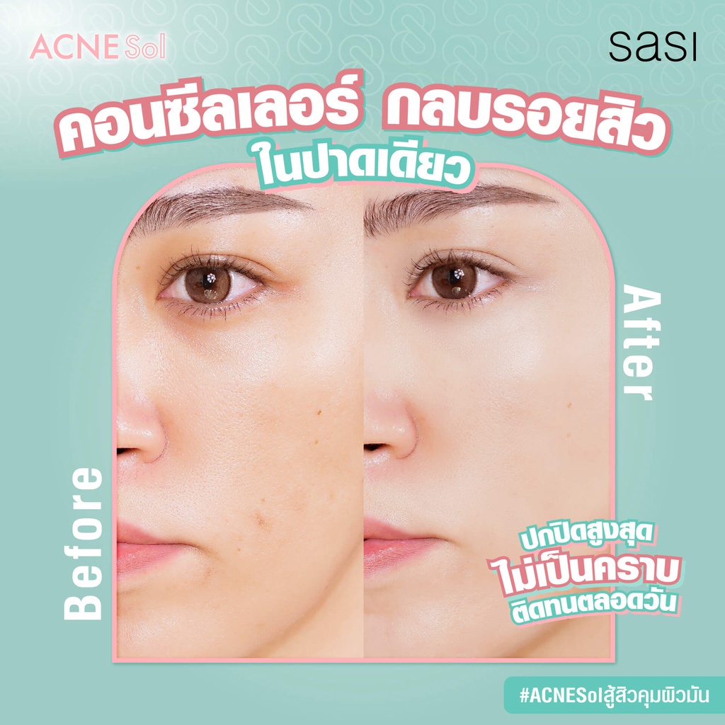 แบบซอง-ศศิ-คอนซีลเลอร์-สำหรับผิวเป็นสิว-sasi-acne-sol-matte-concealer-ไม่อุดตัน-ไม่อักเสบ-อ่อนโยน-ปกปิดดี-2มล