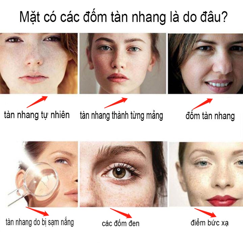 ครีมไวท์เทนนิ่ง-กระ-จุดด่างดํา-กระ-จุดด่างดํา-กระ-จุดด่างดํา-ไวท์เทนนิ่ง-ไม่ระคายเคือง-ขนาด-30-มล-faccmy