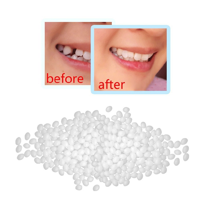 aimy-temporary-tooth-repair-kit-moldable-false-teeth-filling-broken-teeth-gap