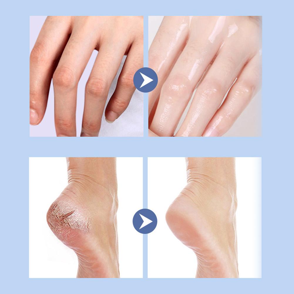 vaseline-ครีมบํารุงผิวมือ-เท้า-ให้ความชุ่มชื้น-ป้องกันผิวแห้งแตก-l8r1