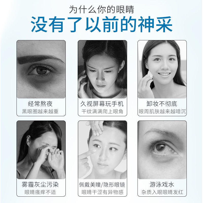 hot-sale-shiny-eye-wash-solution-eye-relief-eye-fatigue-eye-dry-cleaning-solution-eye-washing-artifact-8cc