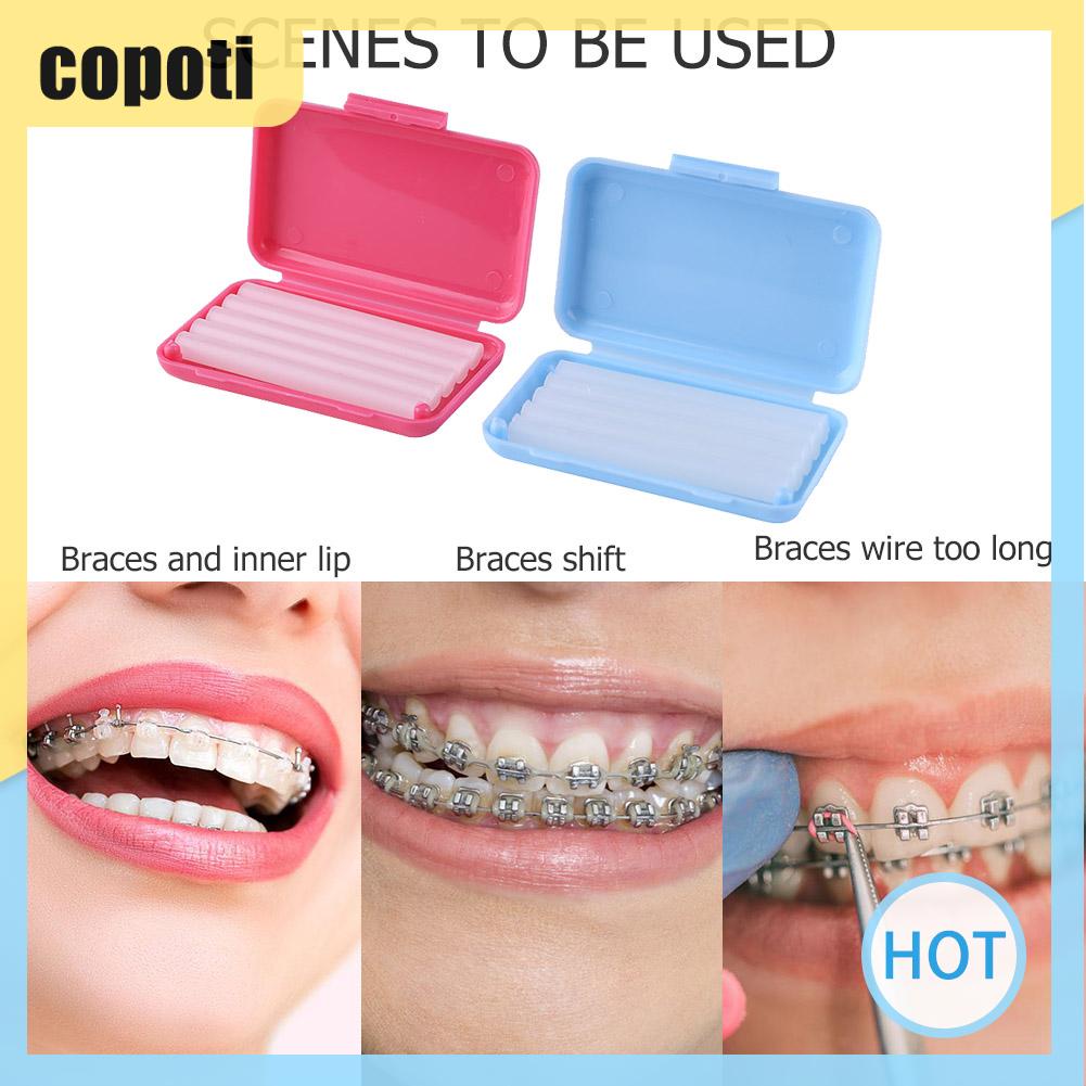 อุปกรณ์จัดฟัน-จัดฟัน-แว็กซ์พิเศษ-5-ชิ้น-ต่อกล่อง-copoti-th