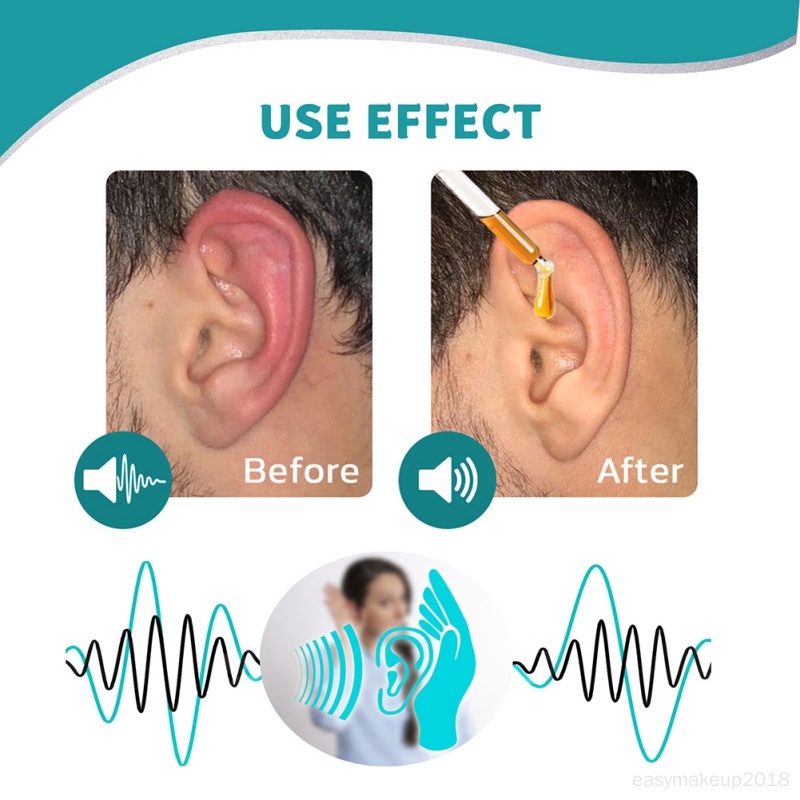 tinnitus-หยดหู-ดีบุก-หูหนวก-หูบวม-ปล่อยออก-ดูแลสุขภาพ-ดีบุก-บรรเทาอาการปวดหู