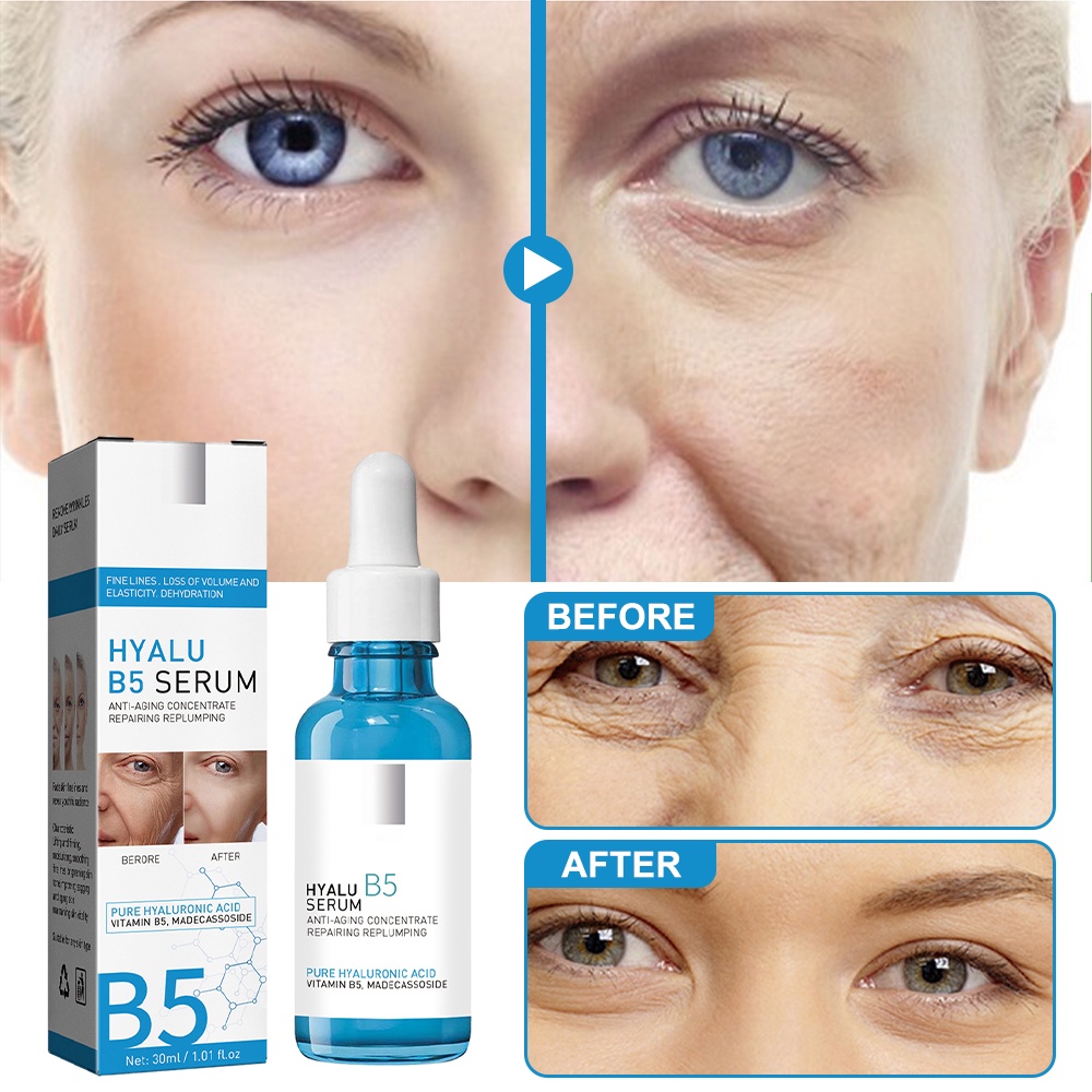 b5-eyes-serum-เซรั่มคอลลาเจน-วิตามิน-30-มล-กระชับผิว-รักษา-และซ่อมแซมผิวทันที-ต่อต้านริ้วรอยแห่งวัย-สําหรับใบหน้า-ริ้วรอย-ผิวหยาบกร้าน